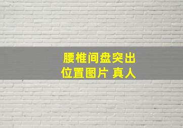 腰椎间盘突出位置图片 真人